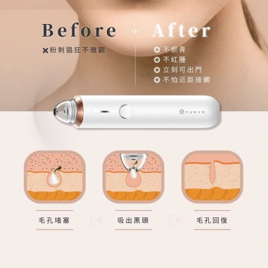 Aurora 小極光 HD 高解析粉刺機NUEVA｜Aurora 小極光 HD 高解析粉刺機